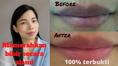 Cara untuk menghilangkan bibir hitam dengan pantas. CARA MEMERAHKAN BIBIR SECARA ALAMI DAN CEPAT & PENYEBAB ...