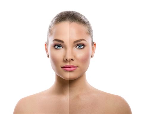 Pigmentation & Sun Damage Removal | Advanced Laser Clinic Cairns