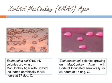 Ppt Stool Culture E Coli O157h7 Powerpoint Presentation Id518630