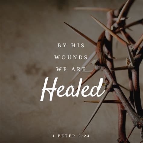 By His Wounds We Are Healed 1st Peter 2 Wounds Christian Quotes
