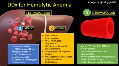 How Do You Workup Hemolytic Anemia Inspired Meded