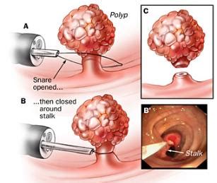 When a patient has insurance, they share payment responsibility with their insurance company. Texas Health Care : Colon & Rectal Surgery / Colonoscopy : Fort Worth, Texas