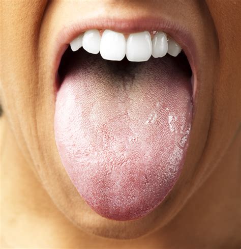 Taste Buds On Tongue Dental Mnemonics Location Of Taste Buds As