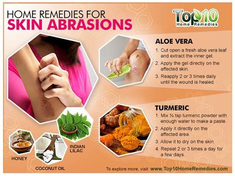 Treating Skin Abrasions At Home 8 Natural Remedies Top
