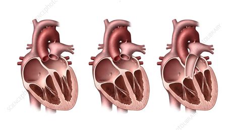 Heart Valves Artwork Stock Image C0103423 Science Photo Library