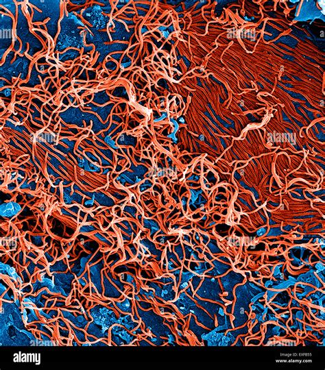 Filamentous Ebola Virus Particles Colored Red Budding From A Stock