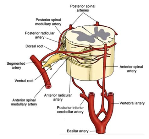 Anterior Cord Syndrome Vertebral Artery