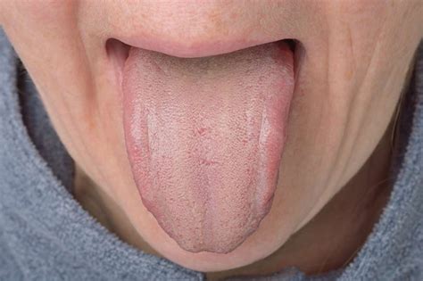 Does Tongue Scraping Help Promote Proper Oral Hygiene We Asked A
