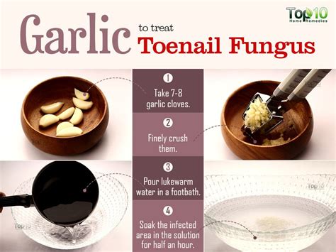 Home Remedies For Toenail Fungus Bewellhub