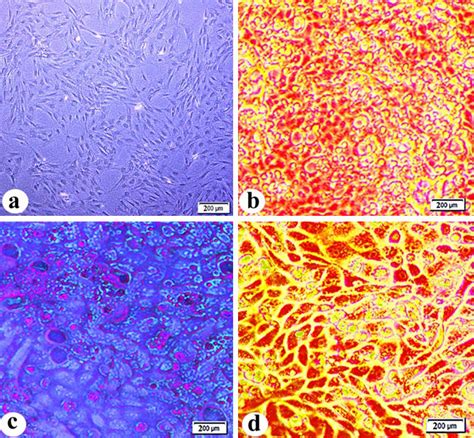 Photomicrographs Of Adipose Tissue Derived Mesenchymal Stem Cells