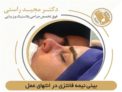 نتیجه جراحی بینی نیمه فانتزی در انتها جراحی بینی جراح بینی اصفهان دکتر مجید راستی