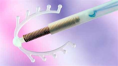Contraception Advice Advanced Womens Health