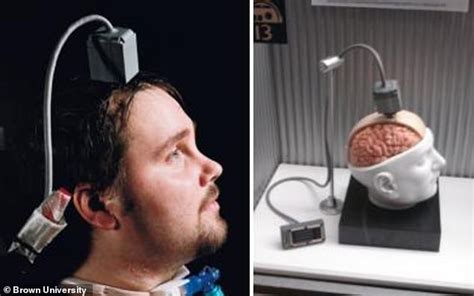 First Wireless Brain Computer Interface Has Performed Successfully In