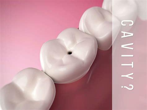 A Cavity Is A Hole That Can Grow Bigger And Deeper Over Time Cavities