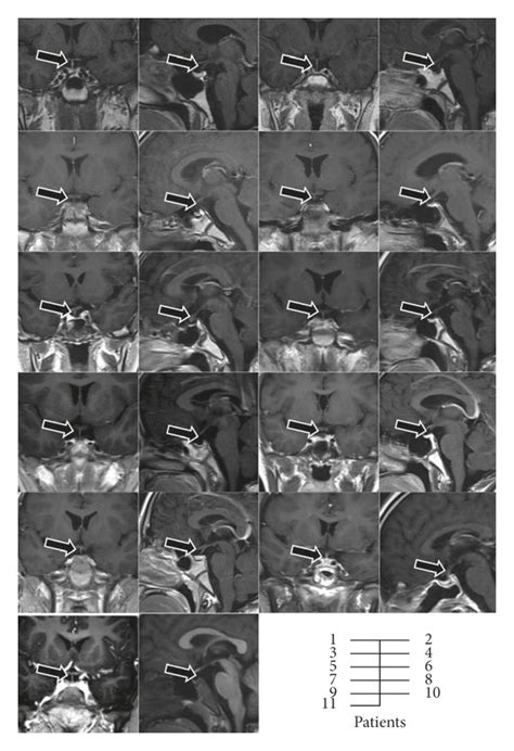Contrast Enhanced Brain Magnetic Resonance Imaging Of Patients A Download Scientific Diagram