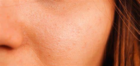 Диета от воспаления поджелудочной железы Диета от воспаления сальной железы - фото презентация Диета от воспаления сальной железы - фото презентация Диета от воспаления поджелудочной железы