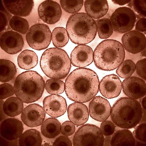 How are animal cells different from plant cells? Afbeeldingsresultaat voor microscopic human skin cells ...