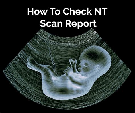 3 Month Nt Scan Report Explained Valuable Insights To Read Results