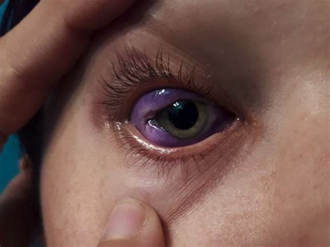 model discovers that getting an eyeball tattoo is just as stupid and dangerous as it sounds
