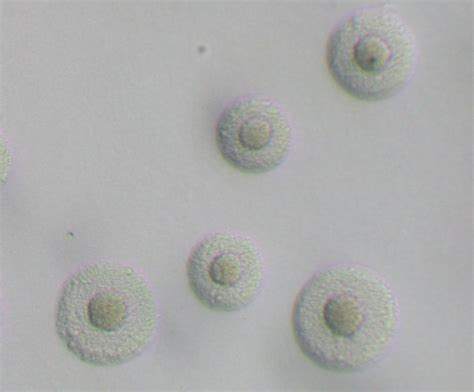 Mycoplasma Hominis Fried Egg Appearance Mycoplasma School Of Medicine Medicine