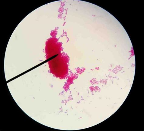 Mycobacterium Bacteria Images And Photographs From Science Prof Online