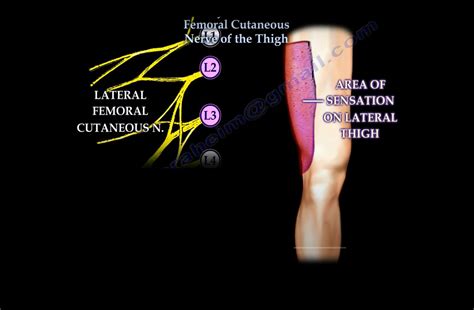 Lateral Femoral Cutaneous Nerve —