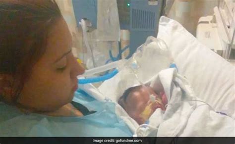 Baby Was Born With Nearly No Skin Doctors Are Fighting To Keep Him Alive