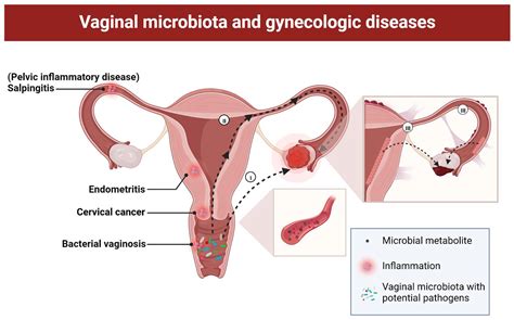 Pharmaceutics Free Full Text Potential Role Of Vaginal Microbiota