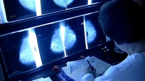 Mammograms New Guidelines Breast Density Information To Be Included