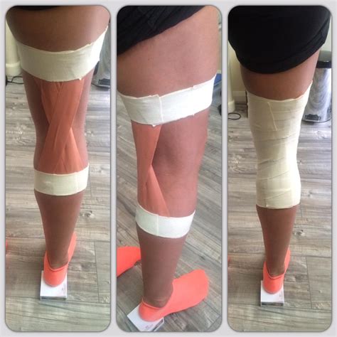 When the hyperextended knee occurs, the joint structures get treatment for hyperextended knee. Rob Ukaegbu on Twitter: "It's a wrap! Knee hyperextension ...