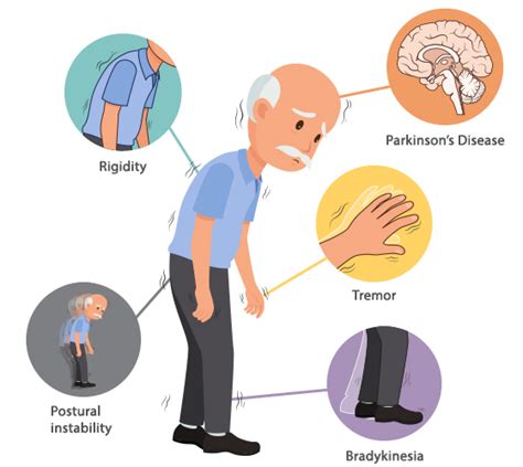 What Is Parkinsons Disease Parkinsons Disease Treatment
