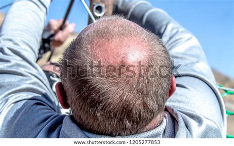 Man Balding Head Top View Stock Photo 1205277853 Shutterstock