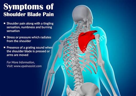 What Causes Right Back Shoulder Pain Know My Pain