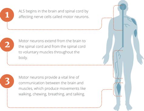 Get to know what areas it affects and life expectancy after diagnosis. What Is ALS - ALS Symptoms | ALS Pathways