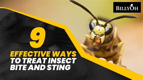 9 Effective Ways to Treat Insect Bites and Stings - Natural Remedies