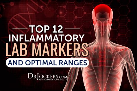 Top 12 Inflammatory Lab Markers And Optimal Ranges