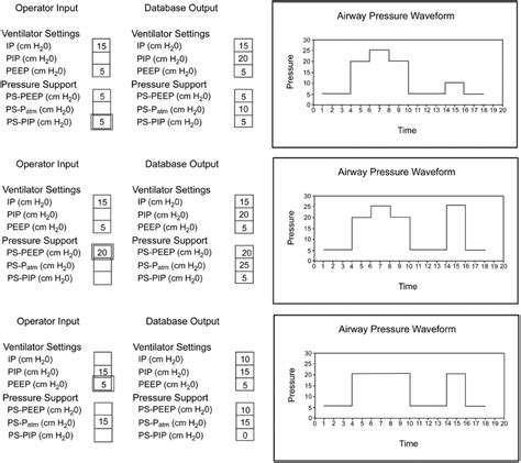 Intubation, with subsequent mechanical ventilation, is a common. Examples of charting simulator output for representative ...