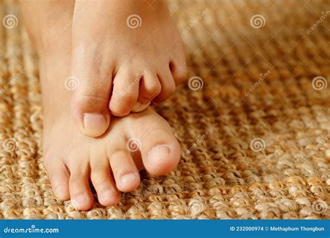 Fungal Foot Itching Caused By Biting Feet Stock Photo Image Of Adult