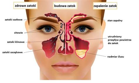 Rak Nosa I Zatok Przyczyny Rodzaje Objawy Leczenie I Rokowania 8947
