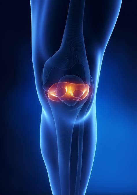 Cartilage cells can be cloned and reproduced in a lab. Knee Cartilage Repair Market - Global Industry Insights ...