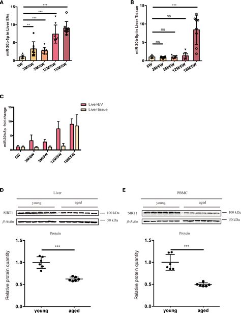 frontiers extracellular vesicle associated microrna 30b 5p activates macrophages through the
