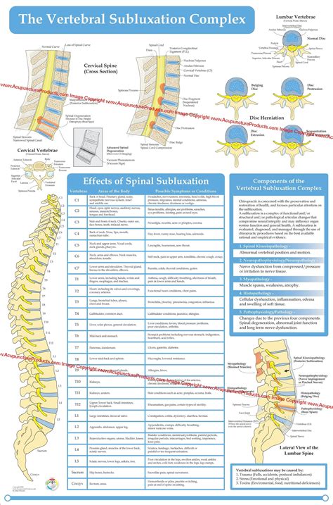 Vertebral Subluxation Complex Spinal Degeneration Poster Cervical Lumbar Spine 24 X 36