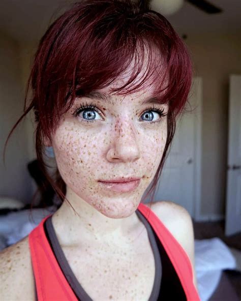 freckled girl freckledgirls