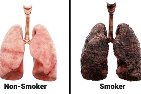 Read The Science Smoking And Lung Damage