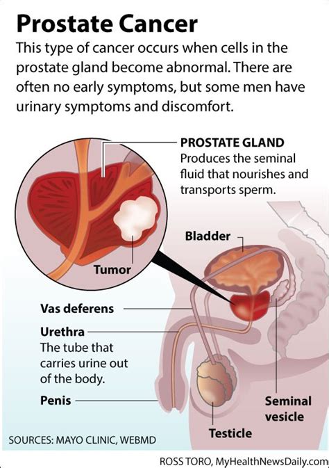 Facts About Prostate Cancer Infographic Live Science