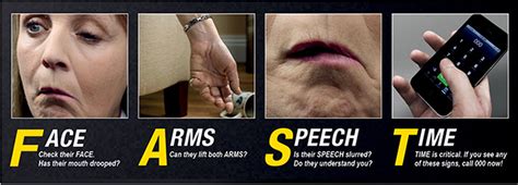 Stroke is a disease that affects the arteries leading to and within the brain. How to recognise the signs of stroke - Peninsula Health