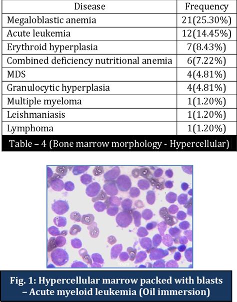 Figure 1 From MORPHOLOGICAL SPECTRUM OF BONE MARROW IN PANCYTOPENIA A