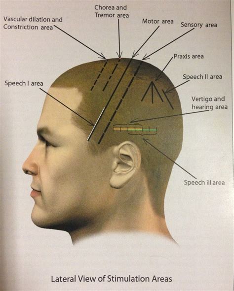 Acupuncture Points On Head Chart