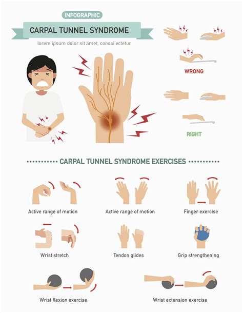 Carpal Tunnel Syndrome What Are The Treatment Options