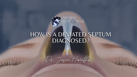 How Is A Deviated Septum Diagnosed Youtube